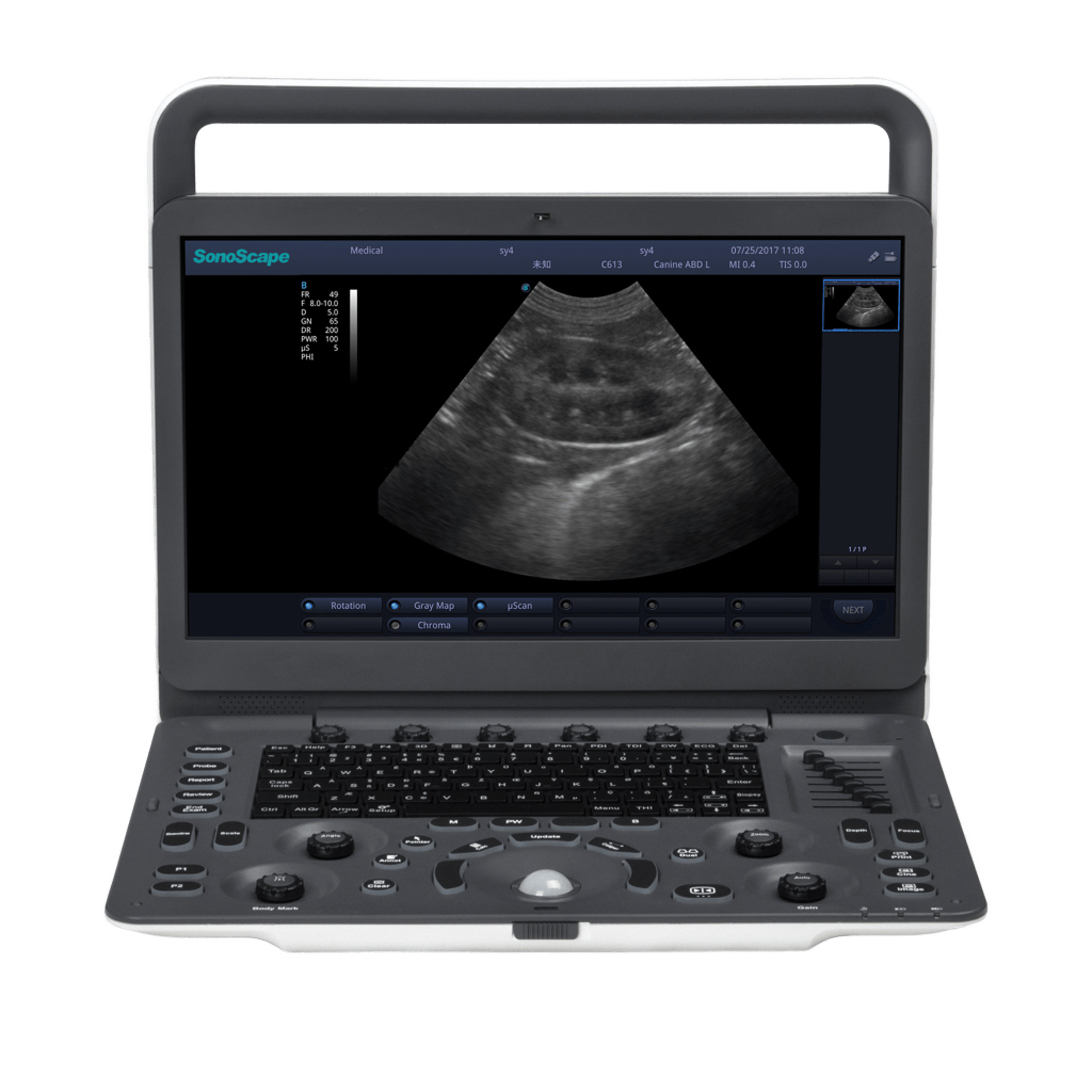 Ultrasound System